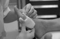 Wondzorg en vilttherapie