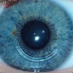 Chris Geysen Contactlenzen