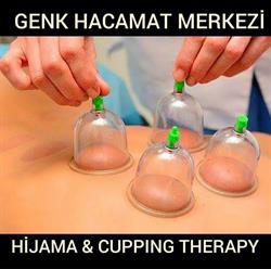 Genk Hacamat Merkezi Hijama en Cupping Therapy