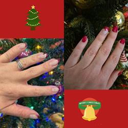 Shinails