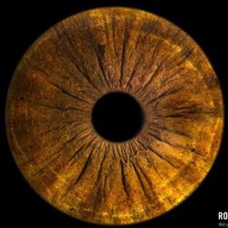Optique Arnold